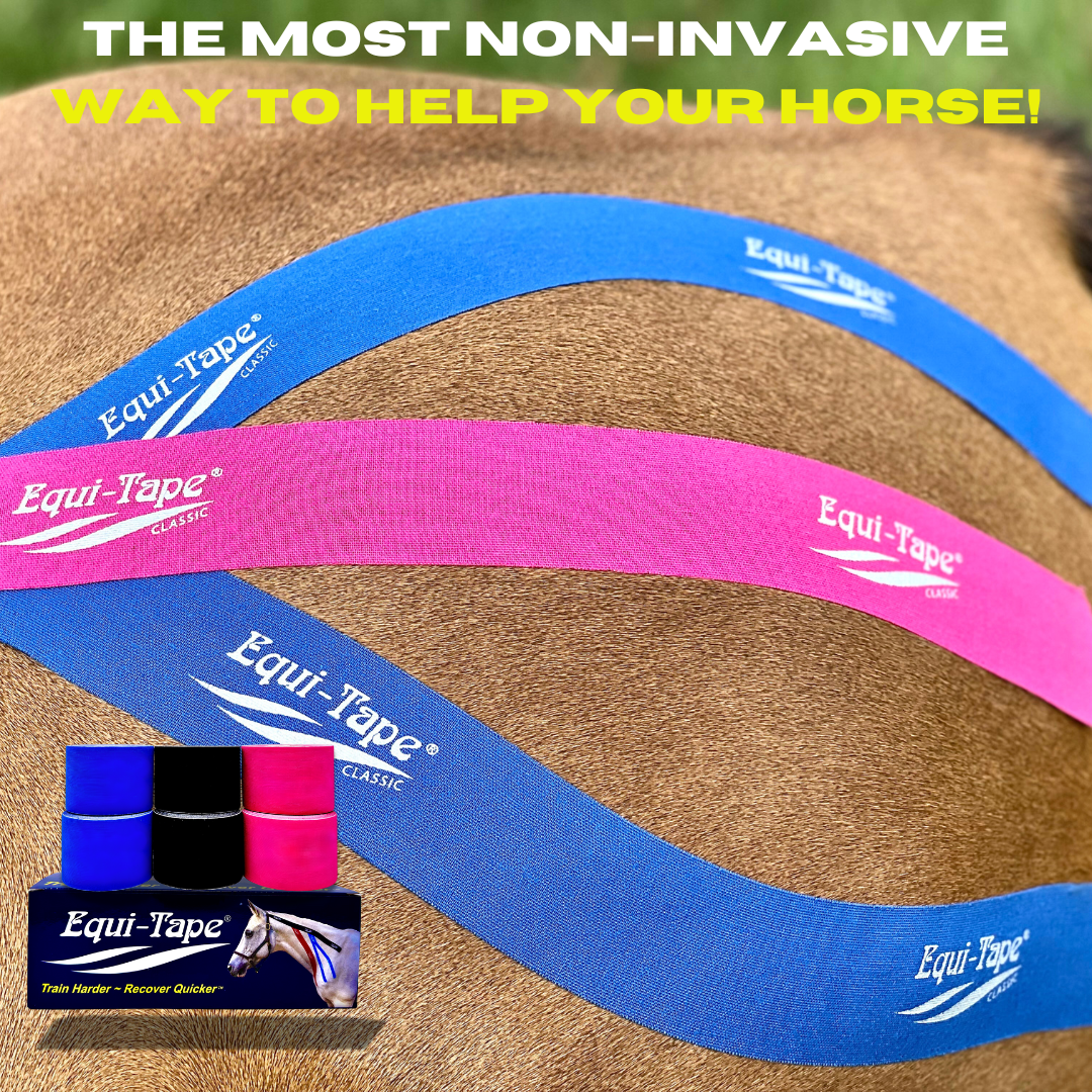 Equi-Tape Advantage 2" Color Pack. 6 rolls of Advantage 2" tape, two rolls of each Advantage 2" Black, Royal Blue, Pink. Equine kinesiology tape made for horses, not just a stickier human tape. 