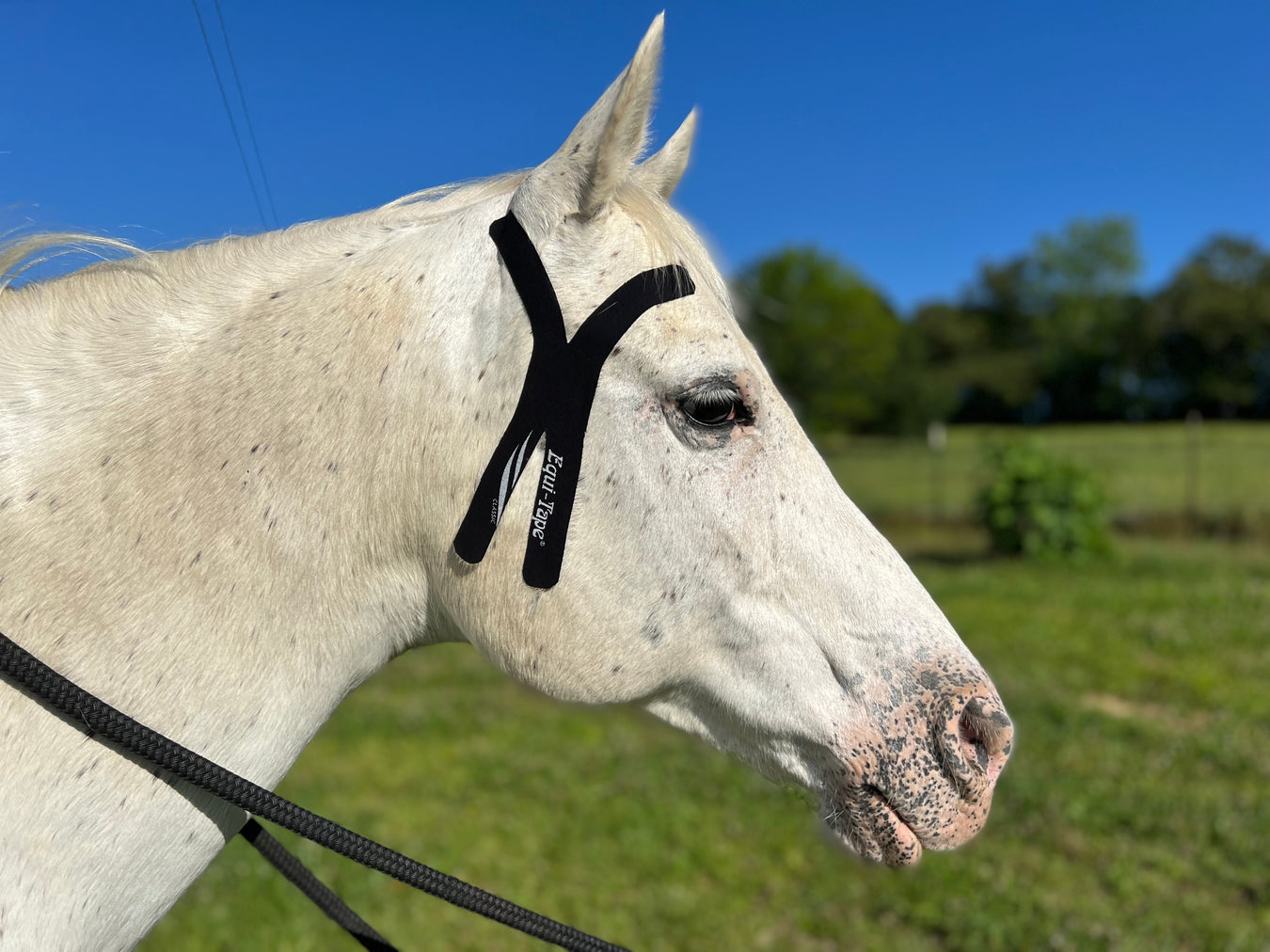 Equi-Tape Application for TMJ support