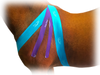 Equi-Tape® application for equine shoulder support. Use Advantage 3" tape for better support.